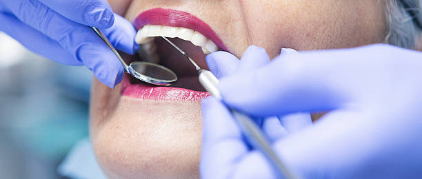 Best Emergency Dental Extractions in Electra, TX